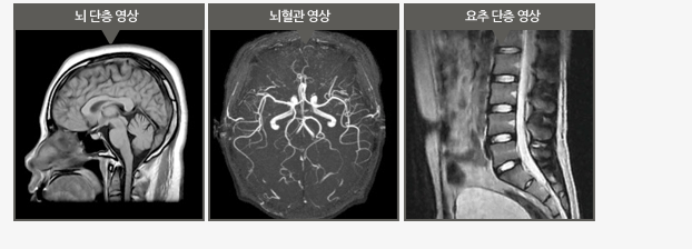 뇌단층 영상, 뇌혈관 영상, 요추 단층 영상